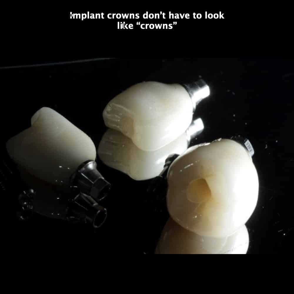 implant website page 1 - Revive Dental Winnipeg