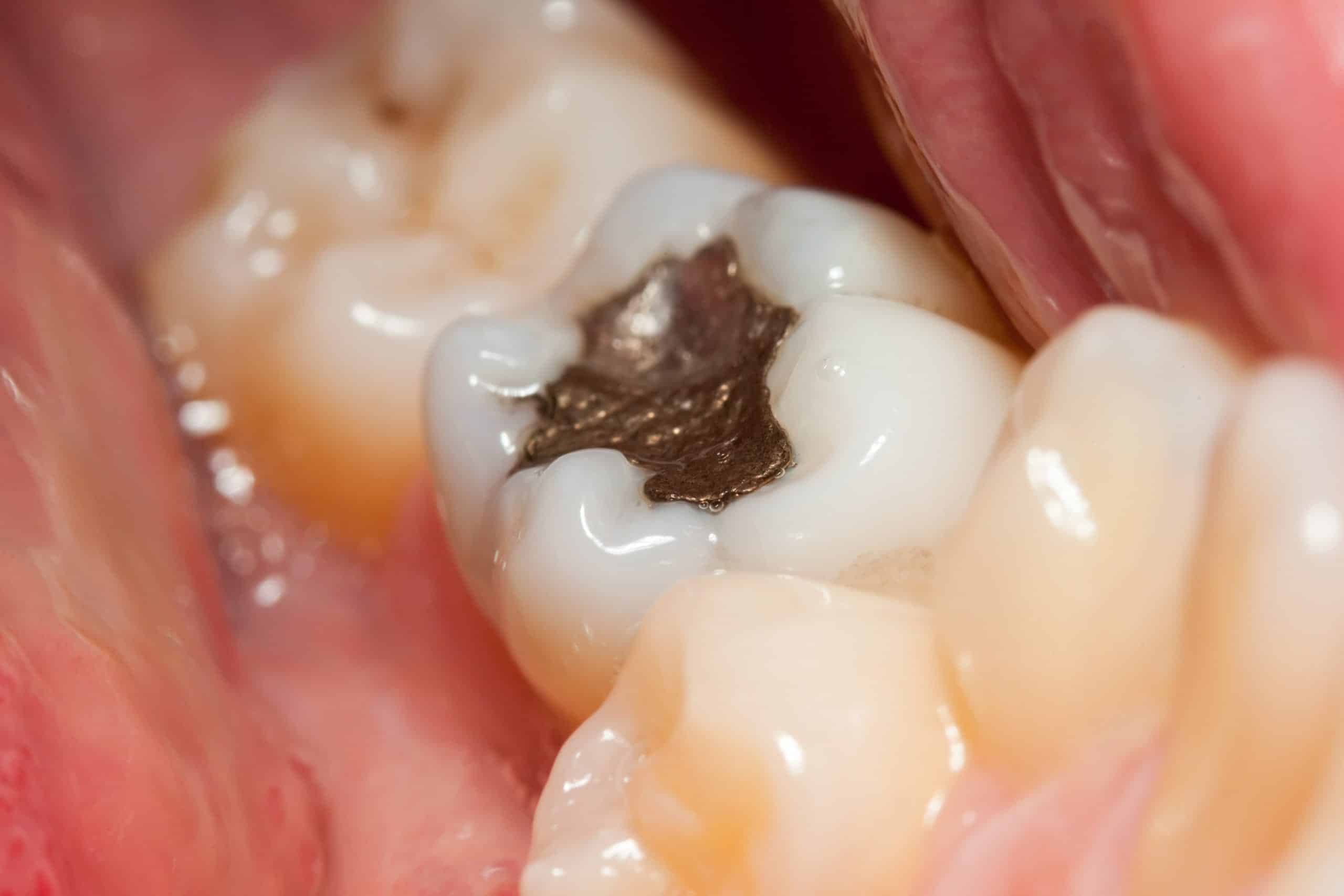 Depositphotos 4018837 xl 2015 min scaled - Revive Dental Winnipeg