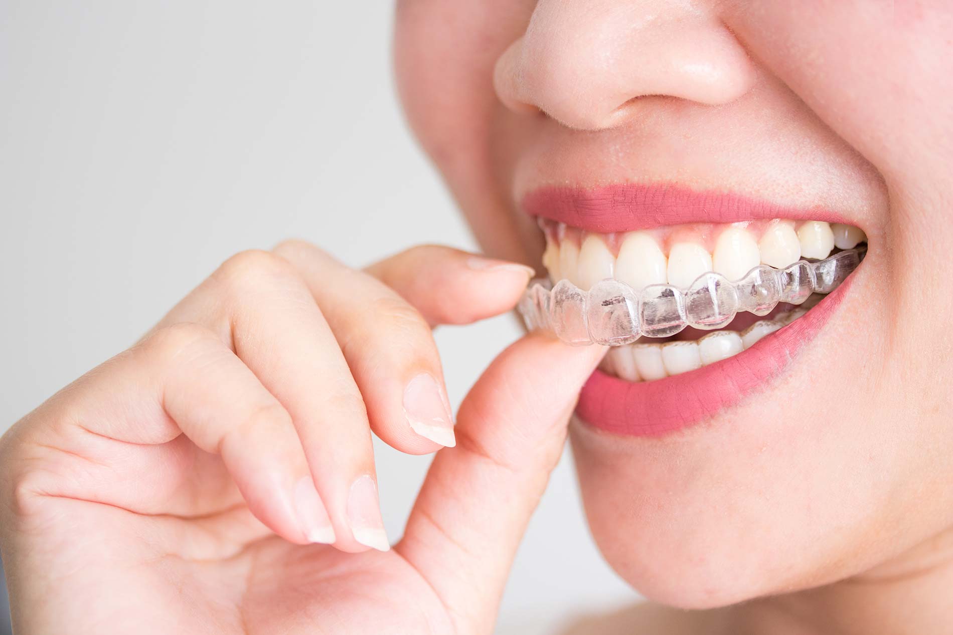 orthodontic dental care - Revive Dental Winnipeg