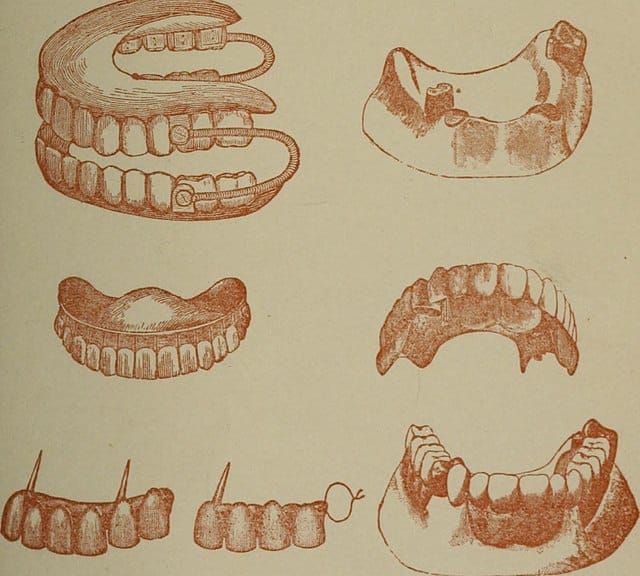 640px Dental prosthesis 1893 - Revive Dental Winnipeg